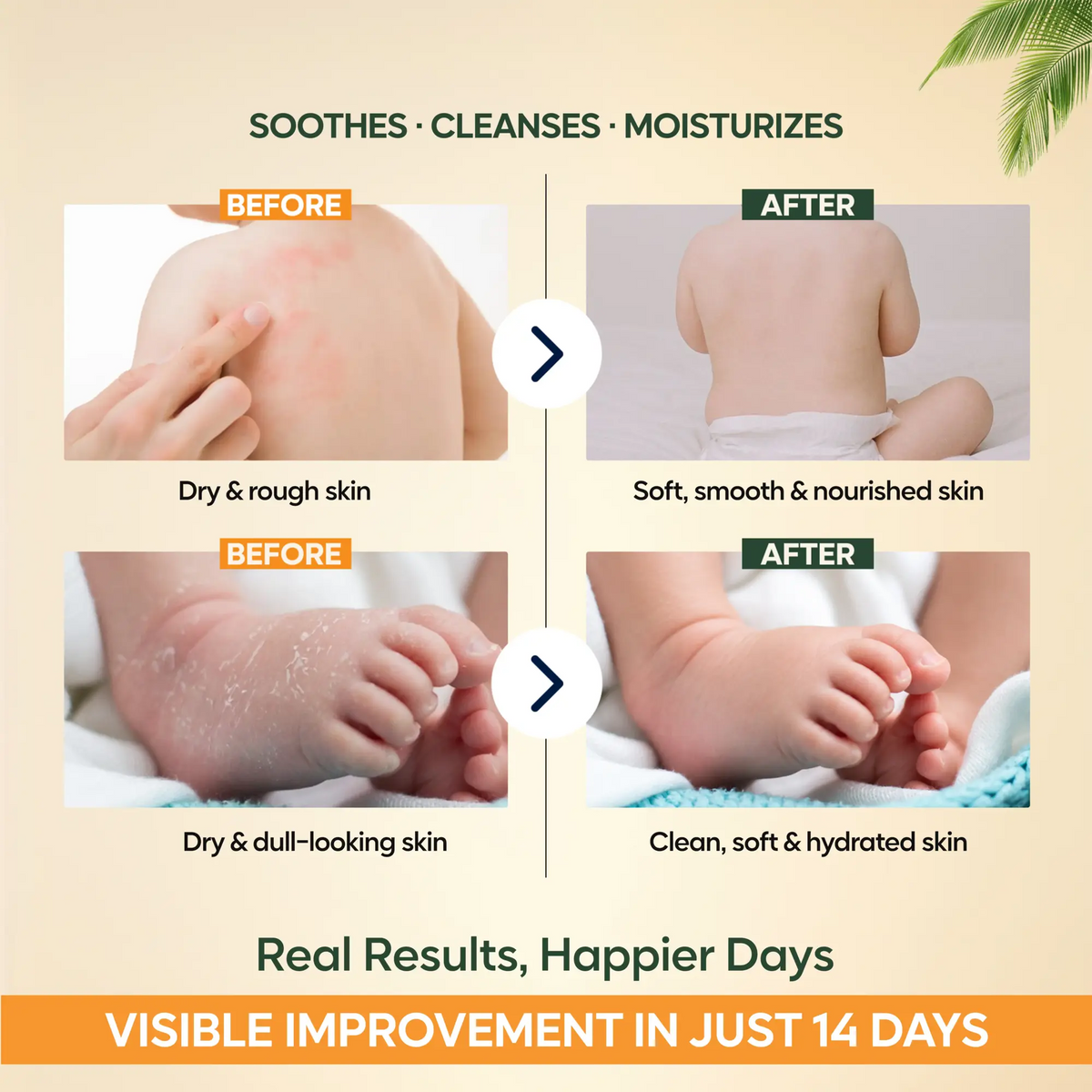 Skin Hydrating Combo Baby Bodywash + Baby Lotion