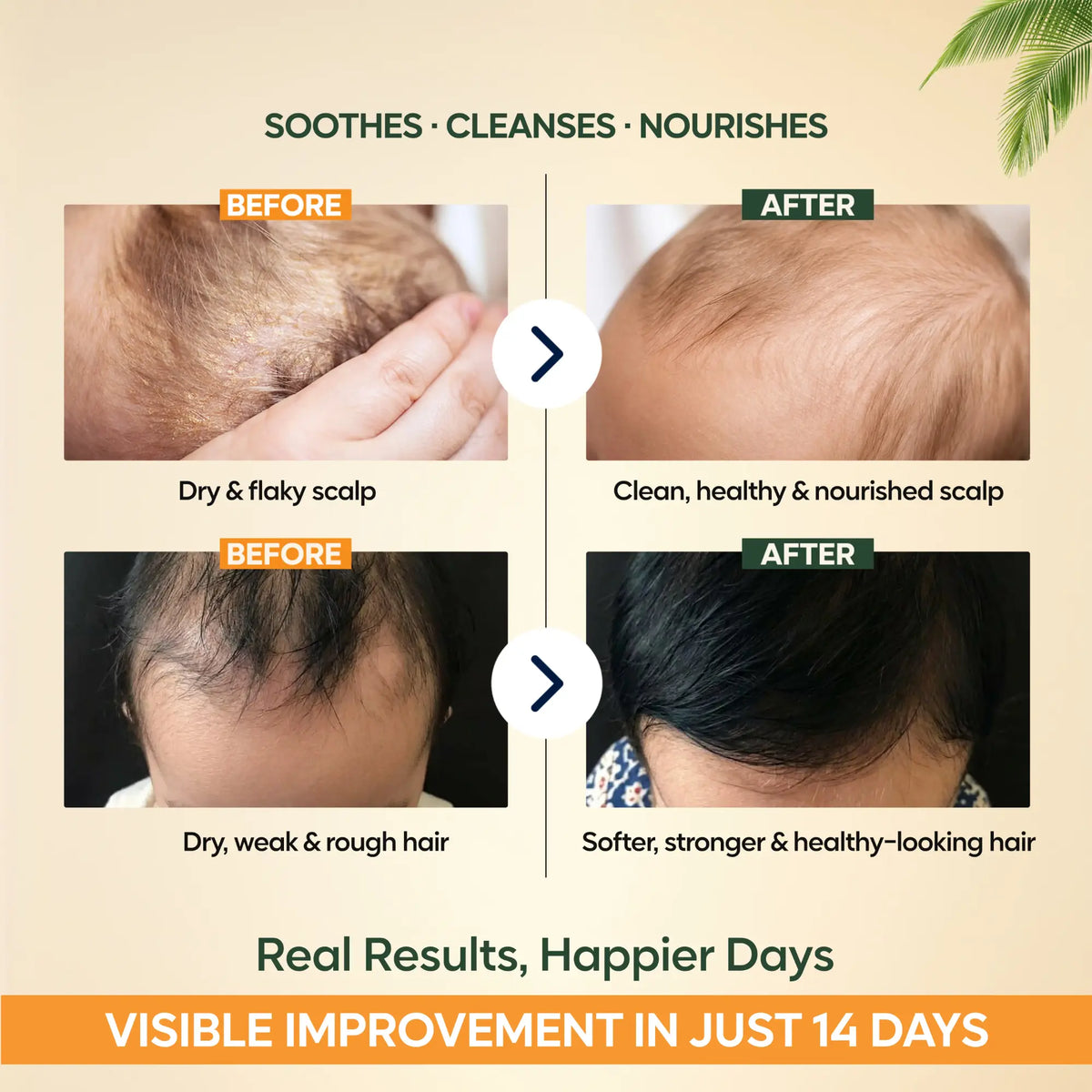 Scalp & Hair Care Combo Baby Shampoo + Baby Hair Oil