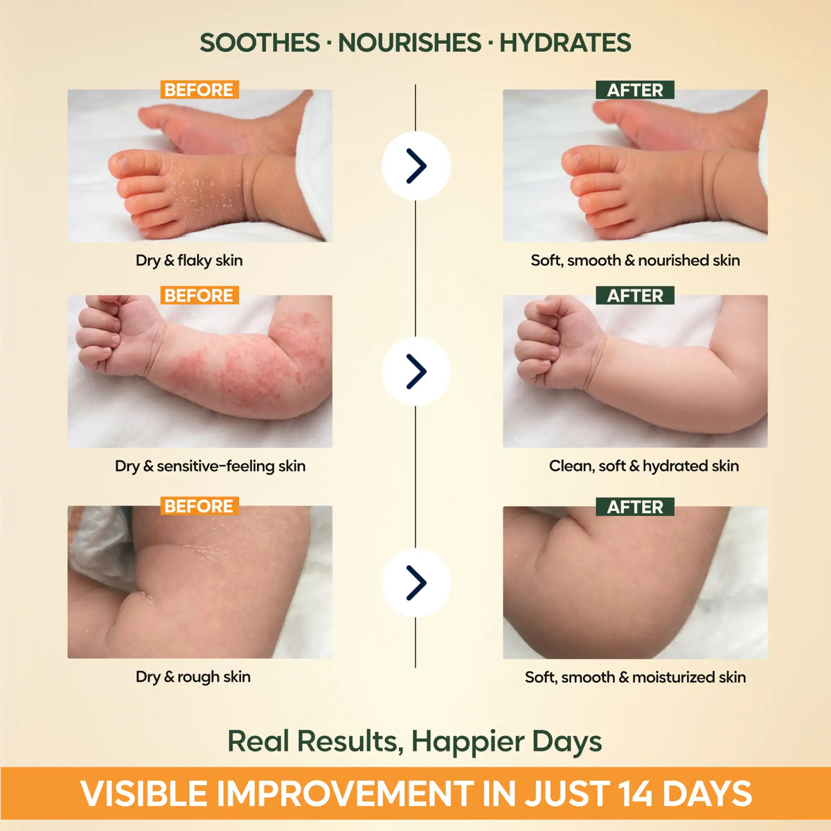Healthy Glowing Skin Combo  Baby Bodywash + Baby Lotion + Baby Massage Oil
